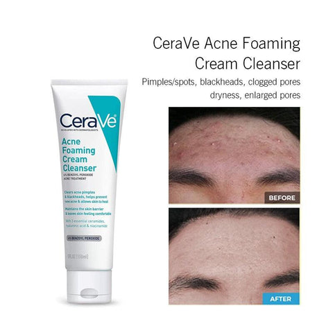 CERAVE 4 IN 1 KIT